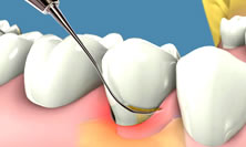 Periodonto